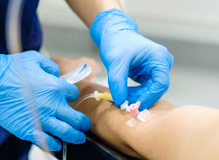 A nurse's hands insert an IV catheter into a patient's forearm during a session of IV ozone treatment with ultraviolet blood irradiation in Denver, Colorado.